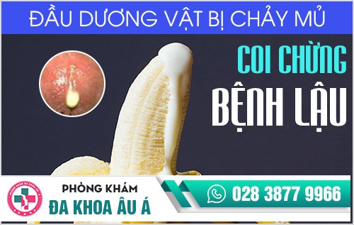 Đầu dương vật bị chảy mủ có phải là biểu hiện của bệnh lậu?
