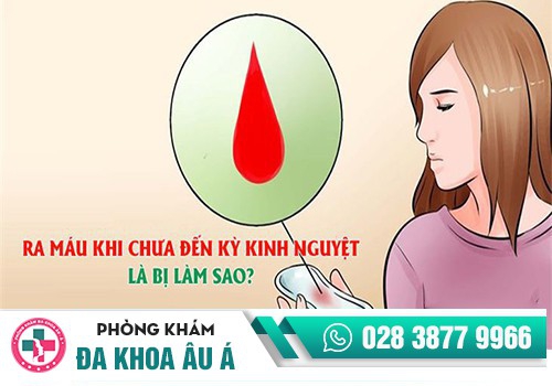 NGUYÊN NHÂN CHẢY MÁU ÂM ĐẠO LÀ GÌ?