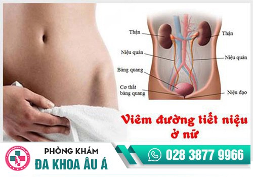 Viêm đường tiết niệu ở nữ (UTI) là gì?