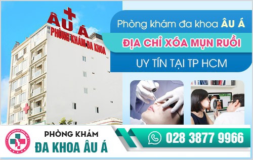 xóa nốt ruồi bằng laser