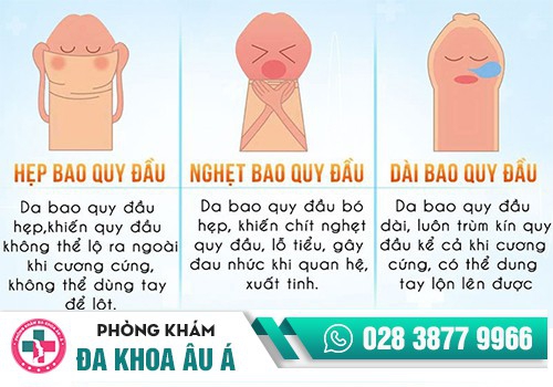 Phân biệt dài/hẹp bao quy đầu