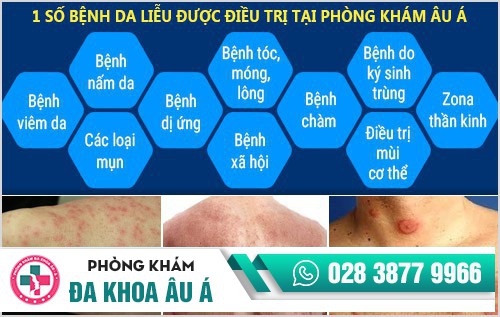 phòng khám da liễu âu á