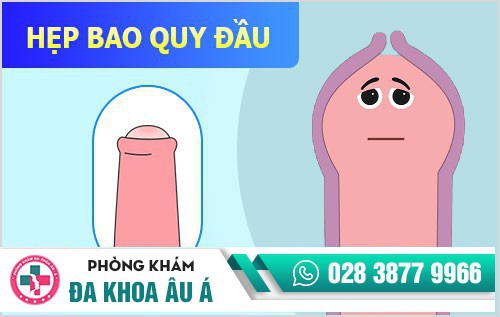 Bệnh dương vật