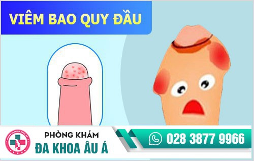 Bệnh dương vật
