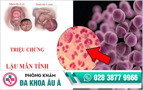 Tìm hiểu về các giai đoạn của bệnh lậu