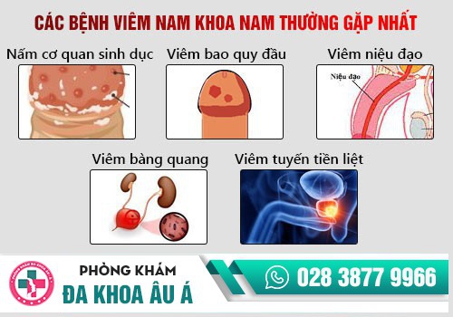 Các dấu hiệu khi mắc bệnh ngoại khoa nam