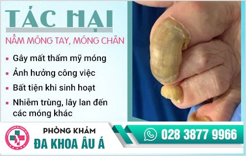 nấm móng chân, nấm móng tay