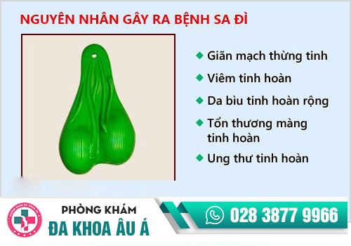 Nguyên nhân gây ra bệnh sa đì là gì?