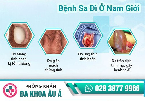 Bệnh sa đì có nguy hiểm không?