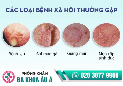 CÁC BỆNH LÝ VỀ DƯƠNG VẬT Ở NAM