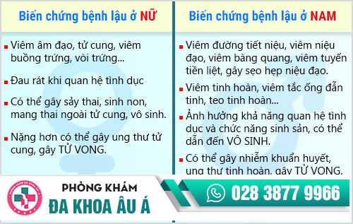 cách điều trị bệnh lậu ở nam giới