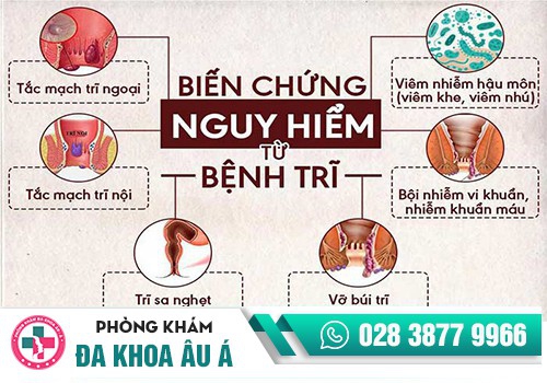 THẮC MẮC BỆNH TRĨ LIỆU CÓ ẢNH HƯỞNG ĐẾN CHỨC NĂNG SINH SẢN CỦA NỮ GIỚI?