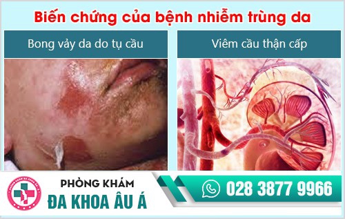 nhiễm trùng da