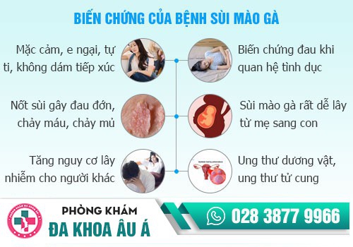 BỆNH SÙI MÀO GÀ CÓ ẢNH HƯỞNG NHƯ THẾ NÀO?