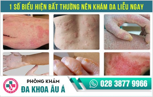 Khi nào nên sử dụng dịch vụ tư vấn da liễu?