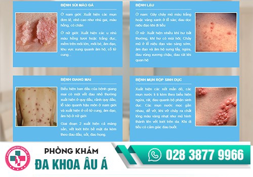 ÂM ĐẠO BỊ HÔI