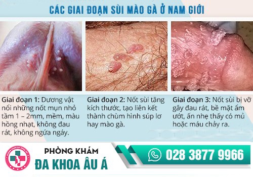 Đau dương vật là bị bệnh gì?