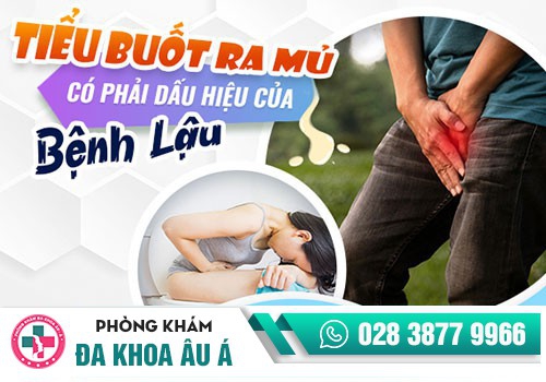 Tiểu buốt ở nam giới có thể là dấu hiệu bệnh gì?