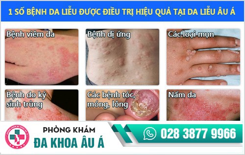 Bệnh viện da liễu quận 3 uy tín, có bác sĩ giỏi