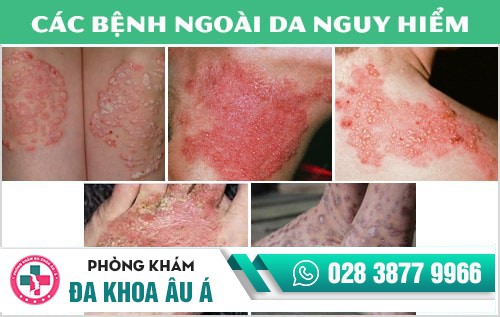 Phòng khám da liễu điều trị bệnh xã hội