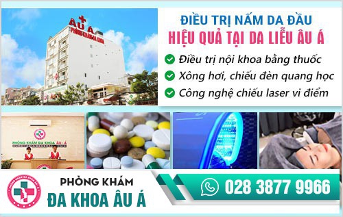 Điều trị nấm da đầu bằng cách nào hiệu quả, không tái phát?