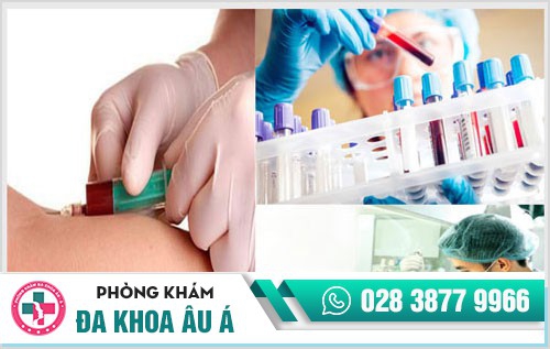 Xét nghiệm bệnh lậu ở đâu uy tín?