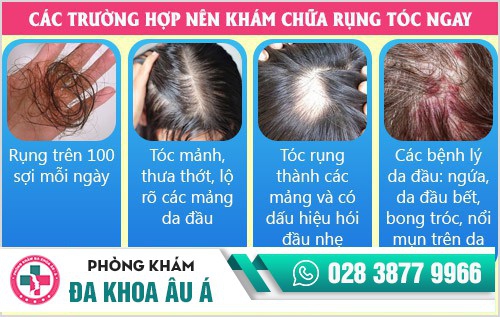 Phương pháp điều trị rụng tóc