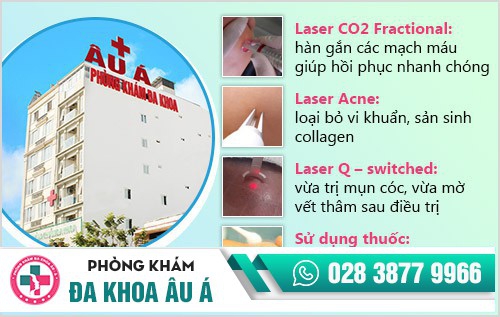 Cách điều trị mụn cóc ở chân nào an toàn, hiệu quả?