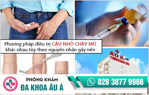 4 nguyên nhân khiến cậu nhỏ chảy mủ bạn cần biết
