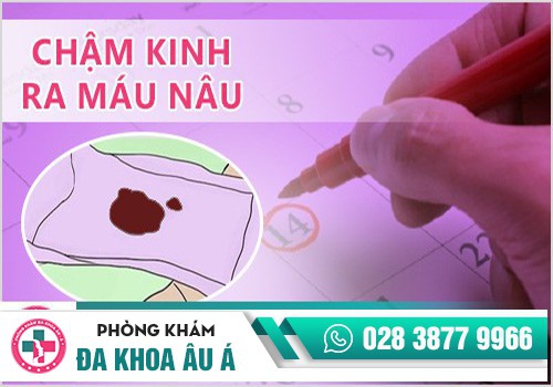 Chậm kinh ra máu nâu có thể là dấu hiệu của mang thai?
