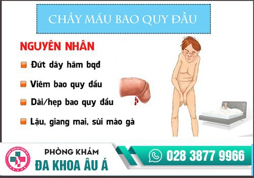 Bao quy đầu chảy máu do quan hệ tình dục