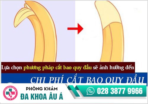 chi phí cắt bao quy đầu