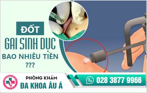 Đốt gai sinh dục bao nhiêu tiền? Đốt ở đâu giá rẻ, an toàn?