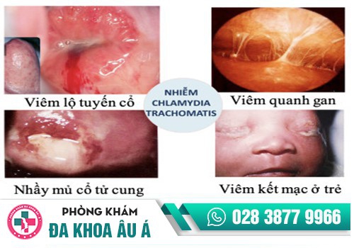 Chlamydia gây ra tình trạng quan hệ ra máu