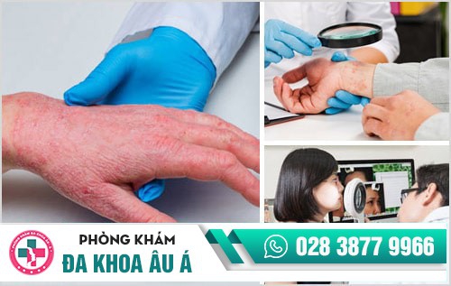 cách chữa ngứa da