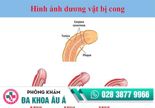Các đấng mày râu nên đến gặp bác sĩ khám dương vật nam giới định kỳ