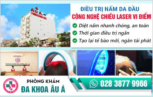 Nấm da đầu cách trị tốt nhất và dứt điểm