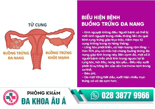 Rối loạn kinh nguyệt 1 tháng có 2 lần là bệnh gì? 