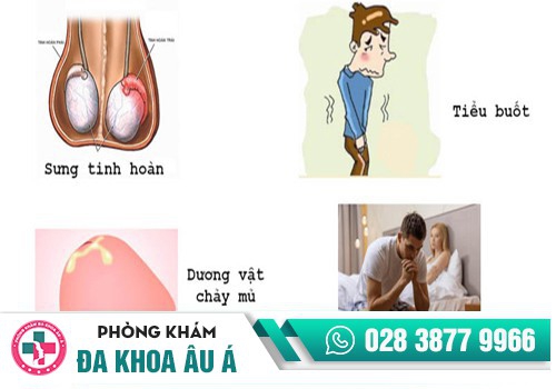 Đau dương vật do bệnh lý