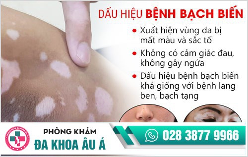 khám bạch biến