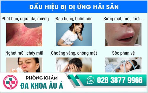 điều trị ứng hải sản
