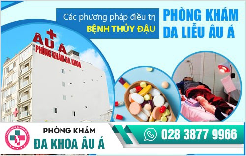 Nhận biết sớm các dấu hiệu của bệnh thủy đậu để điều trị đúng cách
