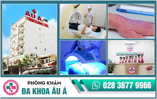 Viêm da dị ứng là gì? Cách điều trị bệnh hiệu quả