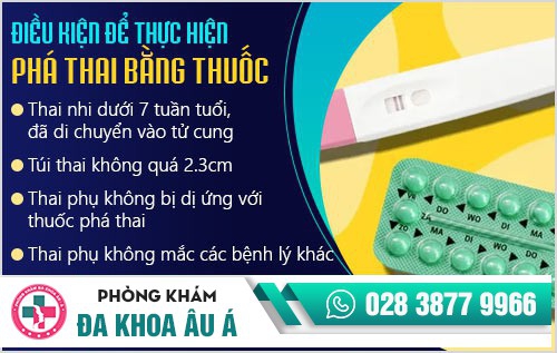 Điều kiện để thực hiện phá thai bằng thuốc