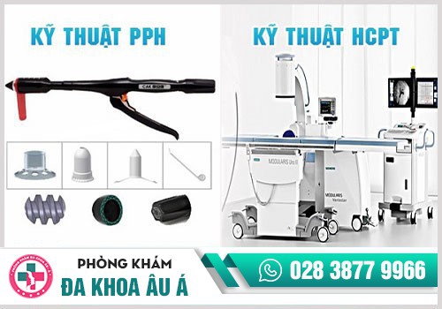 Phương pháp điều trị bệnh trĩ 