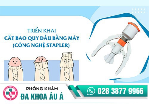 NHỮNG ƯU ĐIỂM CỦA PHƯƠNG CẮT BAO QUY ĐẦU BẰNG KỸ THUẬT XÂM LẤN TỐI THIỂU