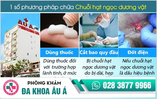 Phương pháp điều trị hạt ngọc dương vật hiệu quả tại Tp HCM