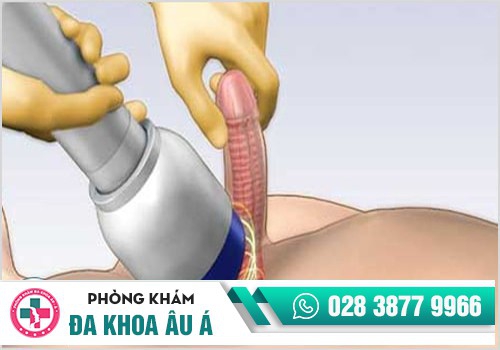 Phương pháp chữa dương vật không thể cương cứng hiệu quả