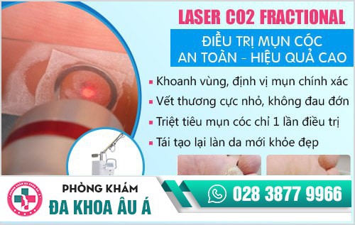 Phòng khám điều trị mụn cóc ở TP.HCM