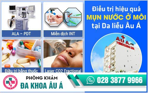 mụn nước ở môi